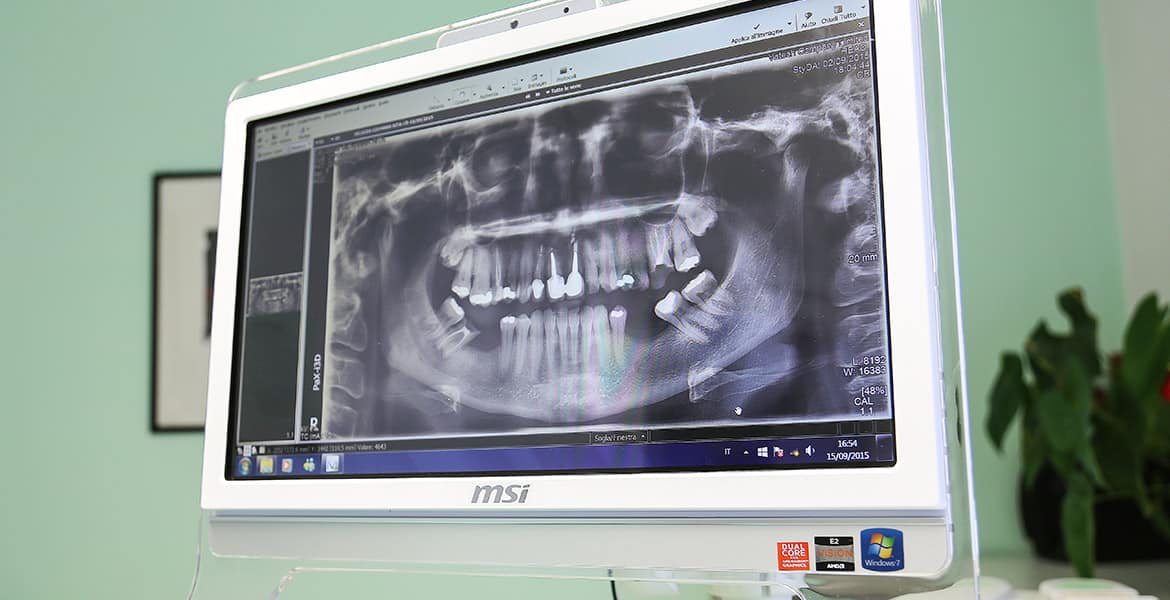 Dentista Sassari: dettaglio poltrona ultima generazione